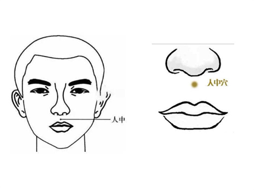 人中留疤对面相有影响吗 后天人中有疤的人命运插图
